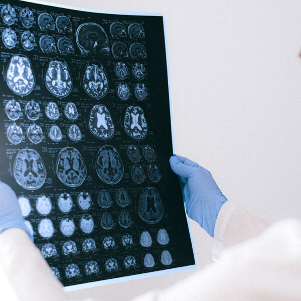 Doctor assessing a traumatic brain injury